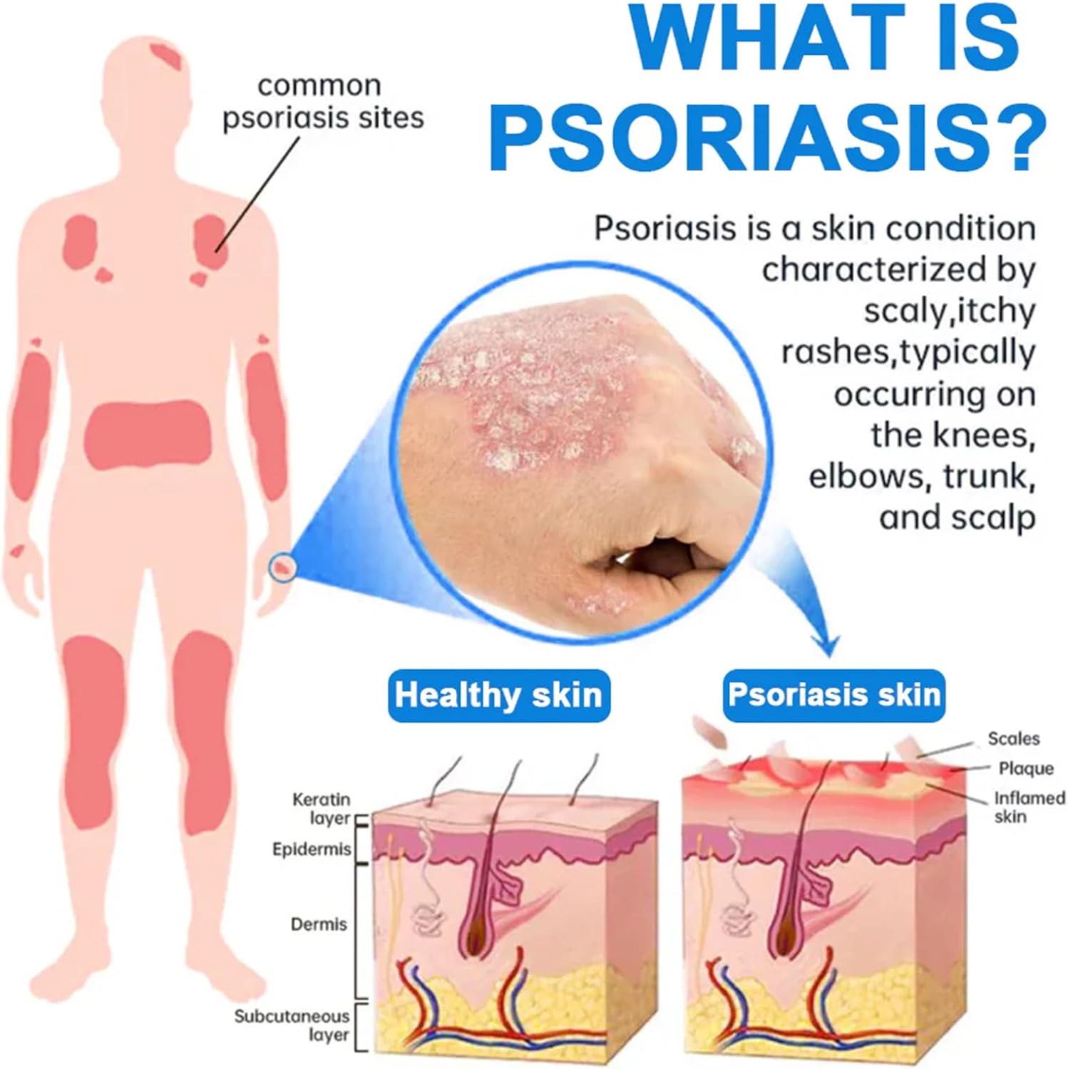 PsoriCalm Magnesium Soothing Spray