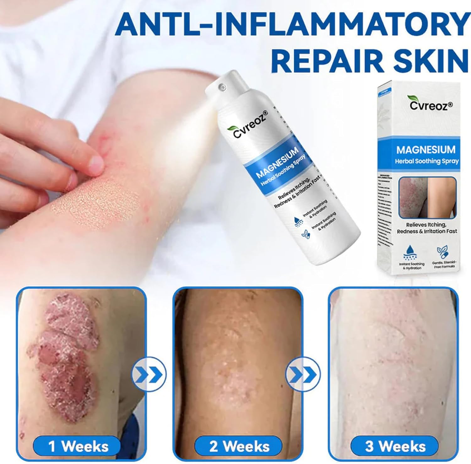 PsoriCalm Magnesium Soothing Spray