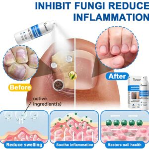 PsoriCalm Magnesium Soothing Spray