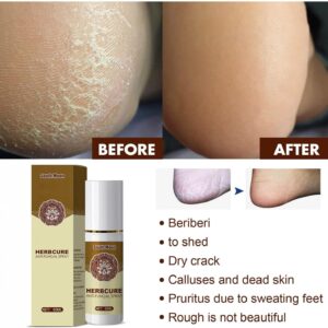 Anti-Fungal Treatment Spray – Fast-Acting Formula for Itching, Odor and Skin Relief