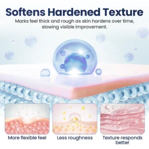 lightweight texture repair gel