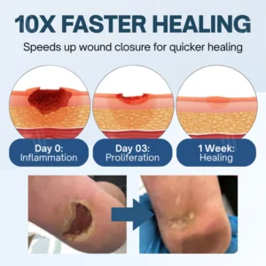 soothing ulcer care topical