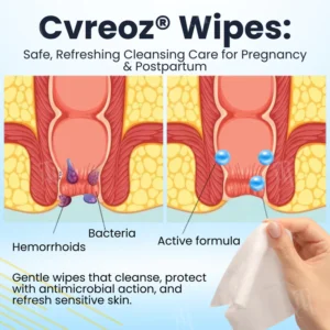 Cvreoz® Herbal Hemorrhoid Treatment Anal Spray + .Wipes
