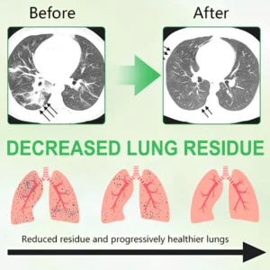 mullein lung support spray