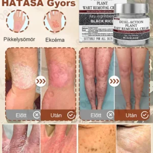 black rice skin regenerating cream