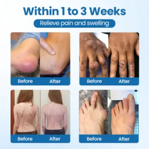 joint repair cream suitable for regular application