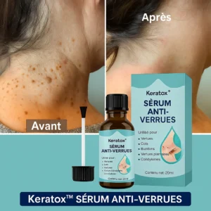 anti wart serum designed for targeted skin care