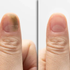 PREMIUM ginger oil for nails