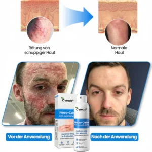Cvreoz® Neuro-Calm Anti-Itch Acute Spray