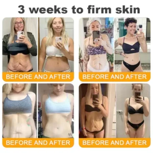 LOVILDS™ Bee Venom Skin Restoration Cream