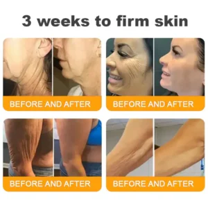 LOVILDS™ Bee Venom Skin Restoration Cream