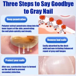 Anti-Fungal Nail Repair Cream – Clear, Healthy & Strong Nails Formula