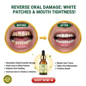 Mouth Opener Tool with Herbal Care Oil jaw exercise kit