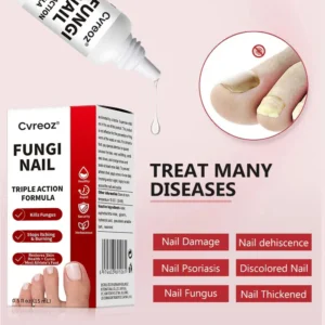 fungal nail appearance care