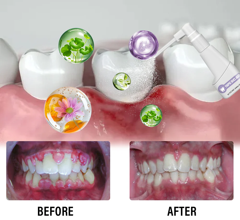 clove oil oral spray