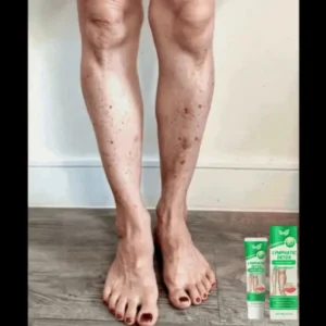 swellfree skin care cream