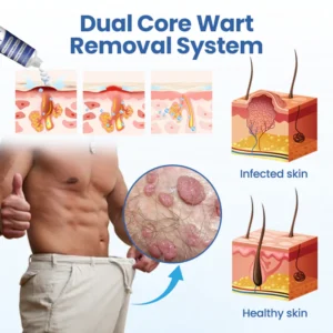 gentle wartaway comfort formula