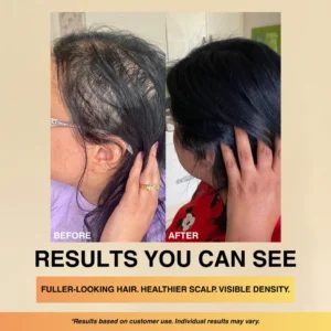 neutral scalp care formula