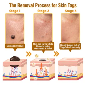 gentle bee venom skin cream