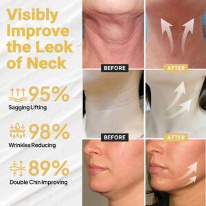 wrinkle appearance care