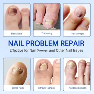 neutral nail care solution