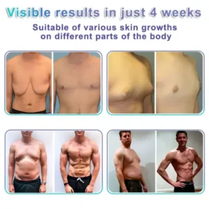 chest comfort skincare patch