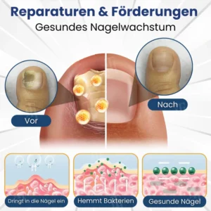 non medical nail care product