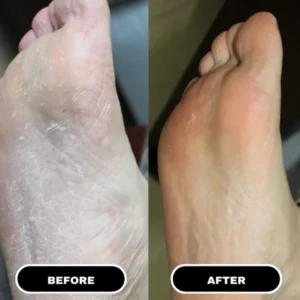 heeluxe foot care stick