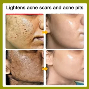 neutral skin care product