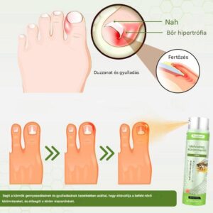 bee venom nail care spray