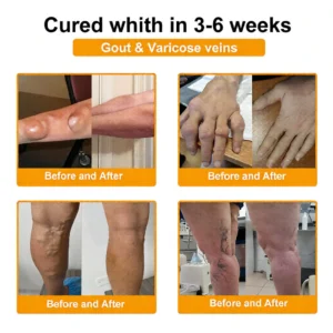 daily bee venom comfort cream