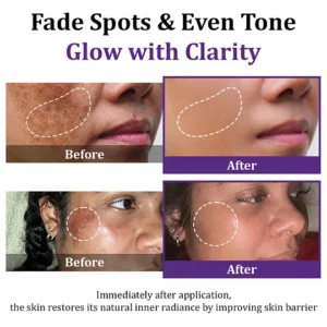 epiglow melanex advanced cream