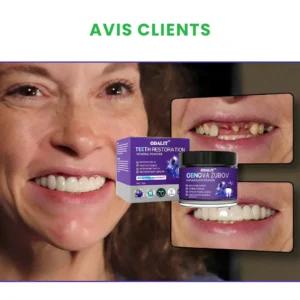 odalit smile restoration kit for gaps