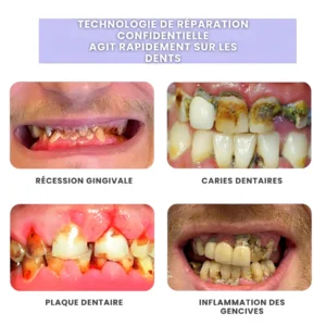 diy dental gap filling kit odalit