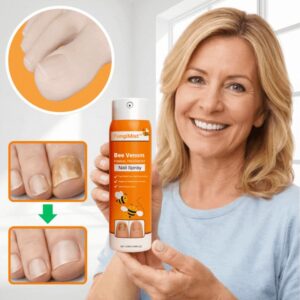 how to use fungimist spray for itchy feet relief