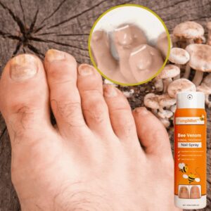 fungimist anti-fungal spray for nail fungus results