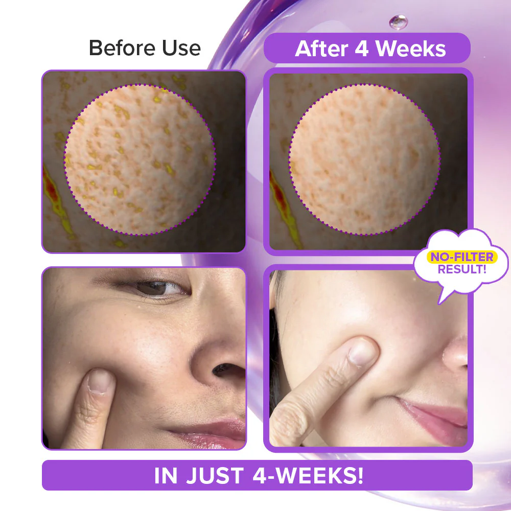 advanced bio-needling renewal cream