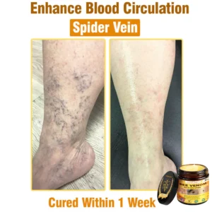 lovilds advanced bee venom face moisturizer