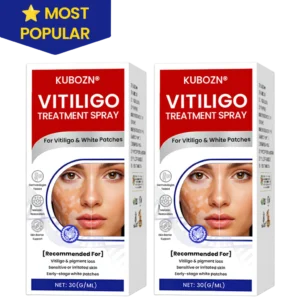 how to apply kubozn vitiligo spray for results