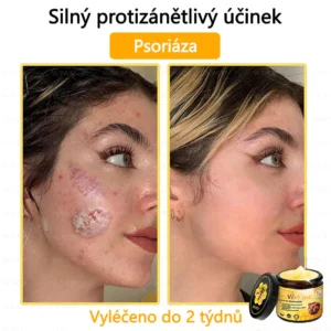 vlsvls luxury skin renewal formula