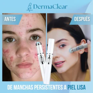 dermaclean professional blemish removal cream