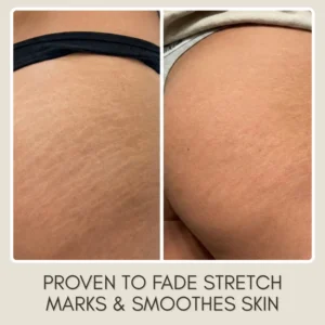 best nourishing oil for silky smooth body texture