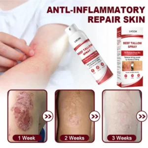 gentle and effective tallow spray laozik brand