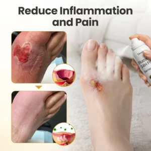 protective foot care solution