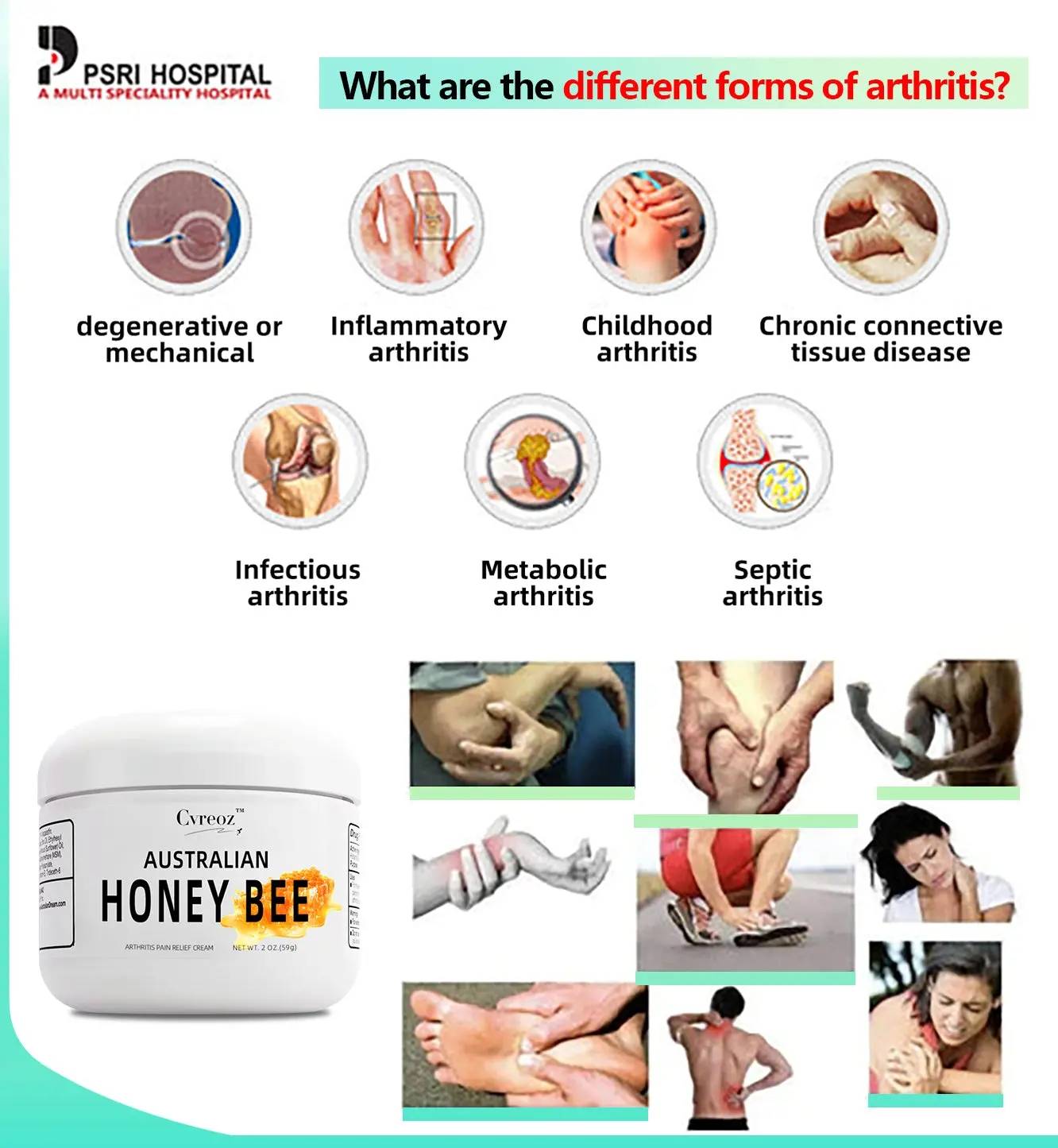 effective arthritis relief cream bee venom