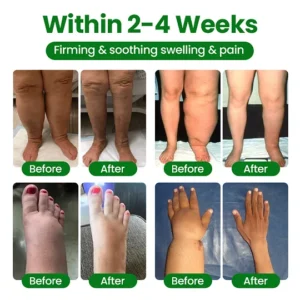 soothing cooling spray for tired legs by laozik