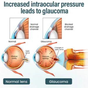 advanced eye vitality drops elycura