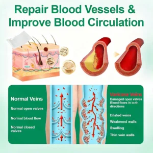 healrize veintarget microneedle patch for leg relief