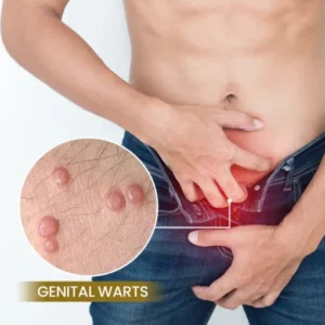 effective skin tag and wart care wartox