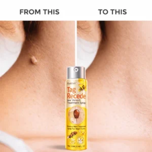 how to use md advance wart remover spray